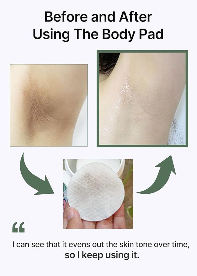 celimax ONE STEP Body Brightening Pad | with Green Tea & White Truffle, For Armpit Under Arm, Knee & Elbow, Dark Spot & Skin Pigmentation, Exfoliating, Hydrating Body Scrub,110ml (60 pads)