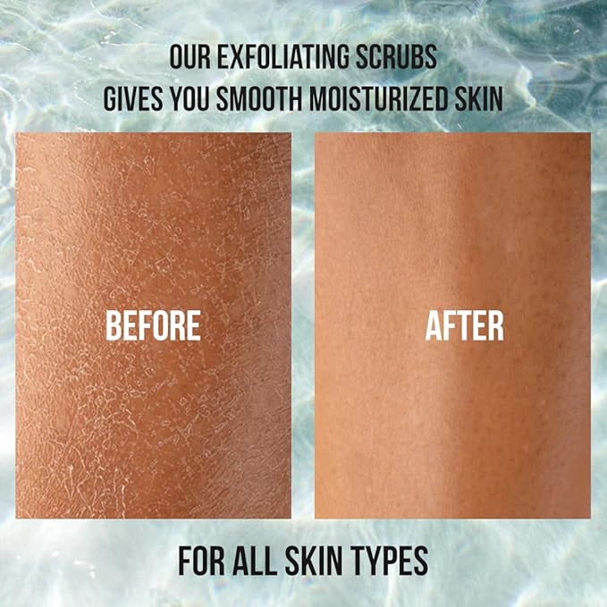 Organic Coconut Oil Scrub, Exfoliating Salt Body Scrub, Deep Cleansing for Soft Skin Remove Dead Skin Cells, Great for Toning Skin, Acne Stretch Marks Cellulite Bump Eraser, Natural Skincare Exfoliant