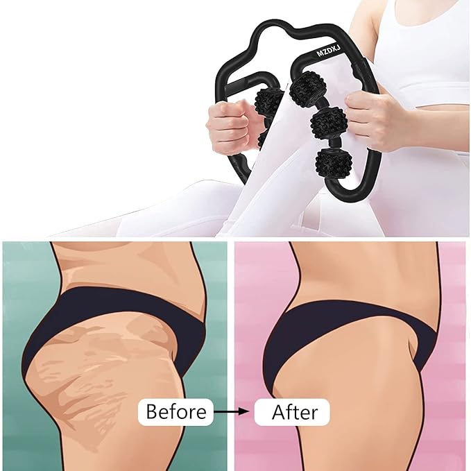 Cellulite Massage Tool Muscle Roller - Deep Fascia Massager & Dimpled Skin Remover for Legs, Thighs & Buttocks - Anti-Cellulite Roller, Smooth Skin, Pain Relief(Black - 6 Wheel)