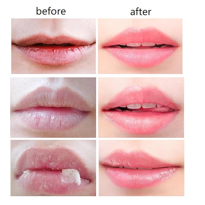 4 PCS Bee Lip Balm Honey Pot,Honey Lip Mask,Honey Propolis Lip Mask Moisturizing Moisture Nourishing Dry & Chapped Lips,Lip Care and Reduces Lip Lines,Lip Exfoliating (Honey)