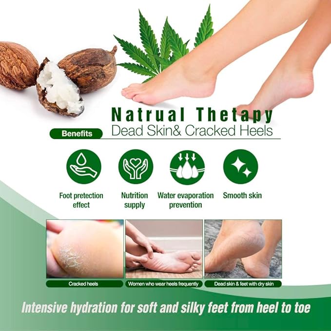 Epielle Nourishing Foot Masks 6 Pairs, Deep Moisturizing Socks for Dry Feet & Cracked Heels, Repair and Nourish with Hemp & Rosemary Extract, Foot Spa & Self Care Gifts for Women, Korean Skin Care