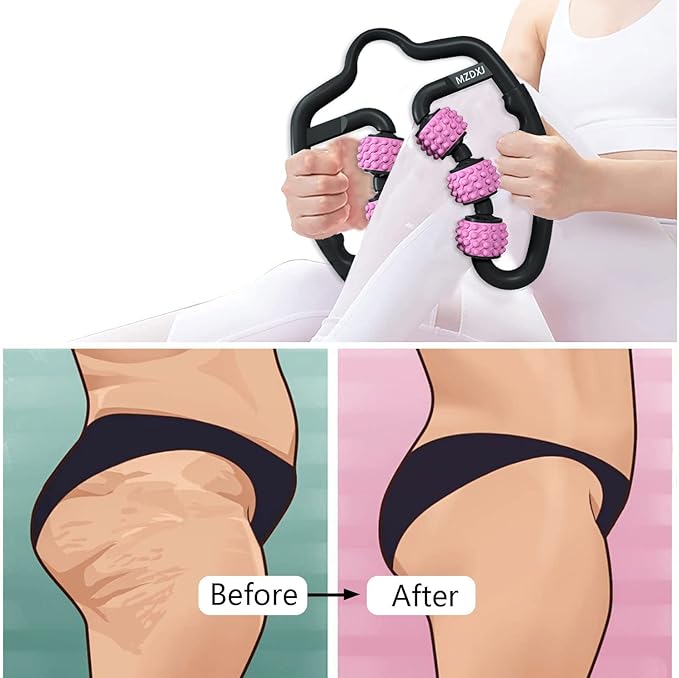 Cellulite Massage Tool Muscle Roller - Deep Fascia Massager & Dimpled Skin Remover for Legs, Thighs & Buttocks - Anti-Cellulite Roller, Smooth Skin, Pain Reliefs (Black Pink -6Wheel)