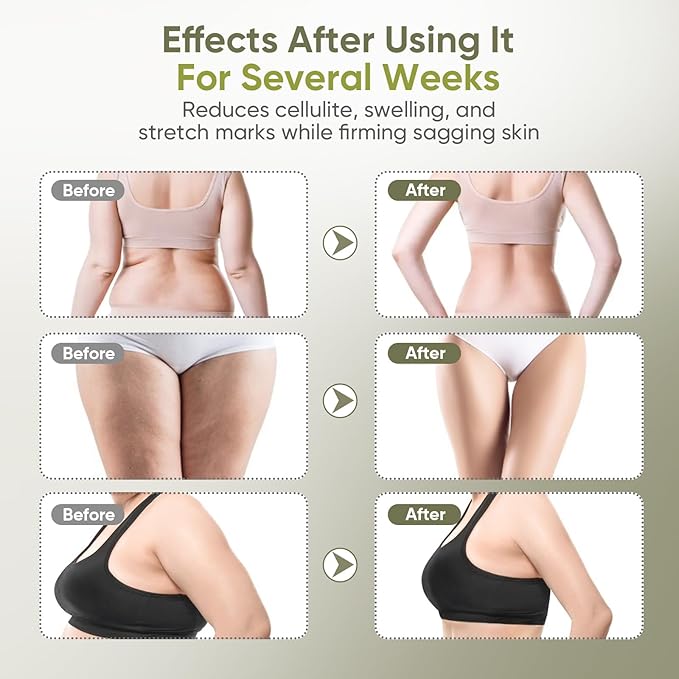 Body Sculpting Machine — Lymphatic Drainage Massager & Anti Cellulite Massage Tool,with Microcurrent, Light Heat & Vibration for Legs, Arms & Belly, Body,Helps Reduce Stretch Marks & Cellulite