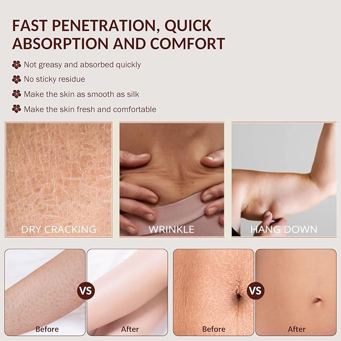 Magic Firming Luxury Body Oil Glow Remedy,Tightening & Hydrating Treatment for Arms,Legs,Stomach & Body | Natural Firming Oil for Dry Skin,Lightweight,Non-Greasy, Nourishing Formula-4.06 FL OZ