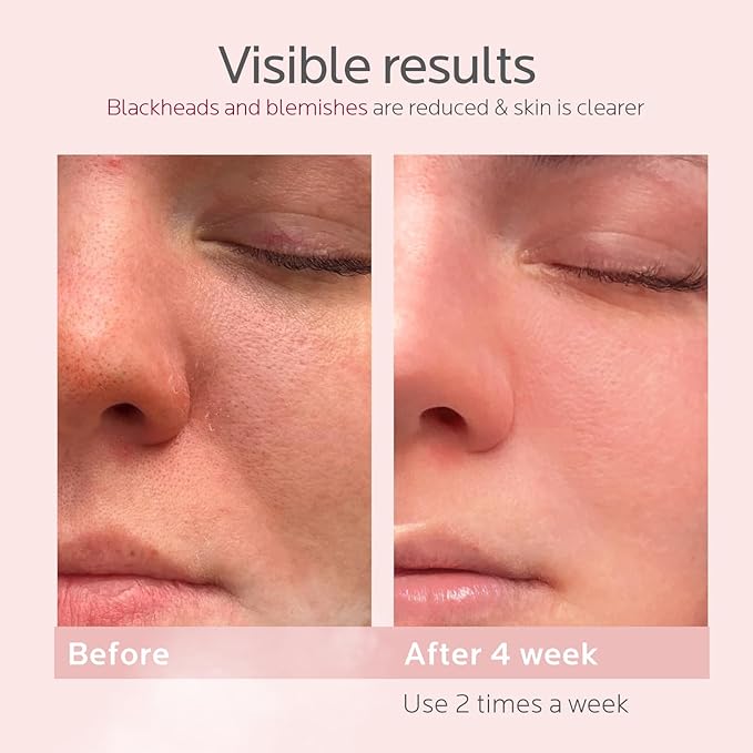 Colorfarm Facial Steamer Skin Care Set: Face Steamer Home Spa Kit Deep Cleaning Unclogs Pores with 5 Skin Care Tools - Spa Relaxing Self Care Gifts for Women (Youth-Boosting & Radiance Spa Kit)