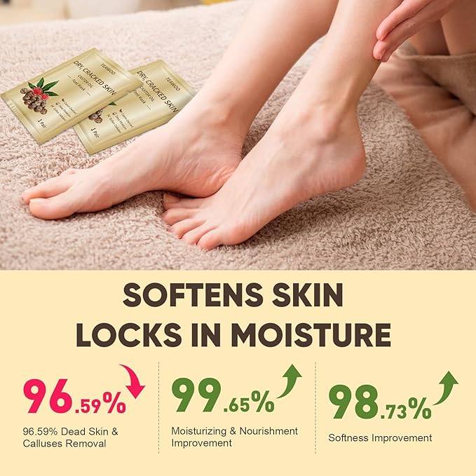 18 Pairs Moisturizing Foot Masks with Castor Oil & Jojoba Oil, Intensely Hydrating Foot Mask for Dry Cracked Feet, Moisturizing Socks for Cracked Heel Treatment