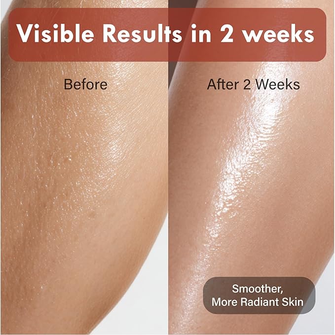 Korean Red Bean Body Lotion for Women - 24-Hour Hydrating Moisturizer for Dry Skin with Peptides & Hyaluronic Acid for Smooth Sensitive Skin - Vegan & Cruelty-Free - 8.45 fl oz