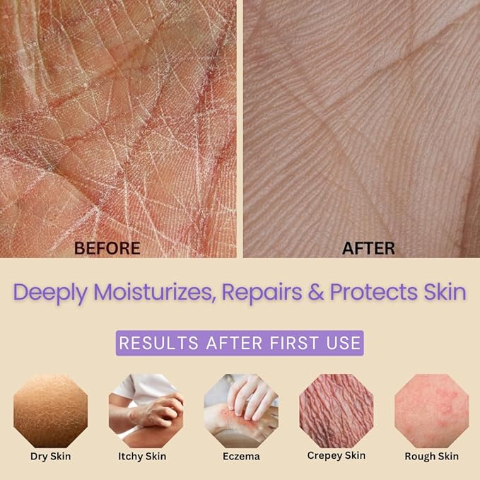 Natural Escapes Lavender Body Lotion for Dry Sensitive Skin, Eczema Relief Moisturizer with Aloe Vera, Olive Oil, Ceramides, Vitamin B5 and E, Hand and Body Cream for Women and Men, 8oz