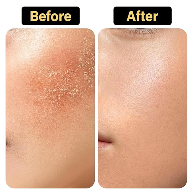 New Whipped Beef Tallow for Skin 4.05oz, 100% Organic Grass Fed Beef Tallow for Face, Pure Tallow Honey and Balm, Beef Tallow, Tallow Moisturizer for Face & Body, Natural Tallow Balm Nourish All Skin