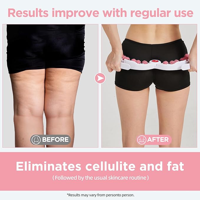 Cellulite Massage Tool Muscle Roller - Deep Fascia Massager & Dimpled Skin Remover for Legs, Thighs & Buttocks - Anti-Cellulite Roller, Smooth Skin, Pain Reliefs (Pink)