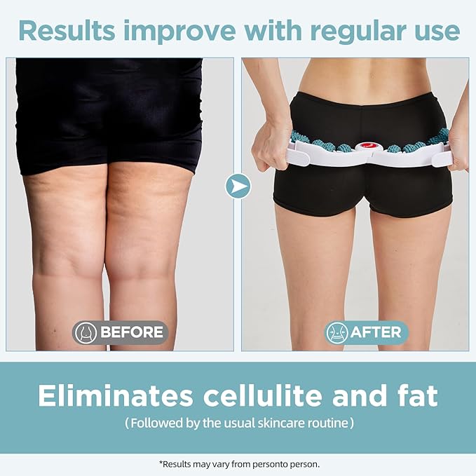 Cellulite Massage Tool Muscle Roller - Deep Fascia Massager & Dimpled Skin Remover for Legs, Thighs & Buttocks - Anti-Cellulite Roller, Smooth Skin, Pain Reliefs (Green)