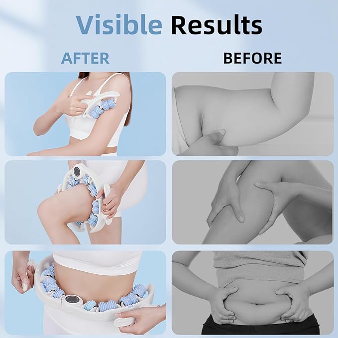 Cellulite Massage Roller for Legs, Anti Cellulite Massage Tool with Detachable, Fats Remover for Legs, Thighs, Butt, Fascia Massage Tool for Lymphatic Drainage & Deep Tissue Pain Relief (Blue)