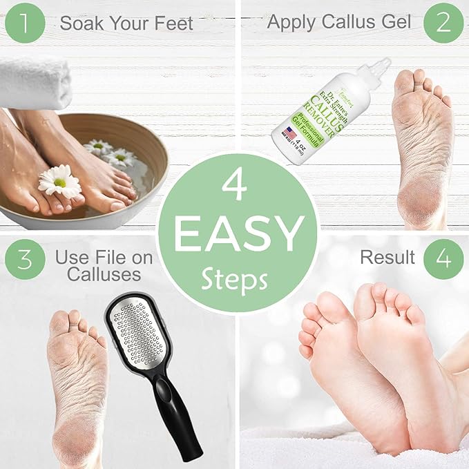 Dr. Entre's Callus Remover Gel & Foot File: Extra Strength Callus Remover for Feet, Foot Callus Remover Care, Pedicure Tools Supplies, Spa Kit, Dead Skin Scrubber, 4 oz