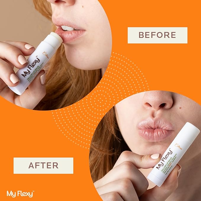 100% Organic Lip Balm Hydrating, Grass-Fed Beef Tallow Lip Balm, Made with Pasture Raised Tallow, Honey, Beeswax, & Orange Essential Oil, Lip Balms & Moisturizers - Bulk Pack of 3