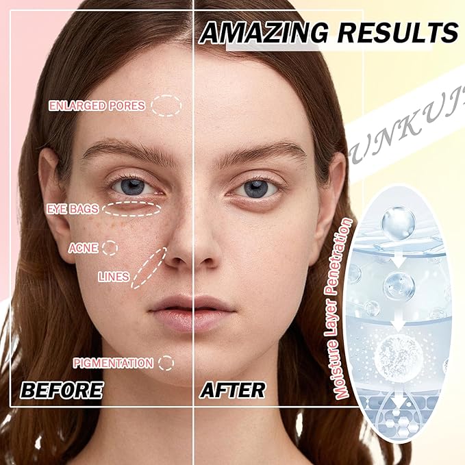 10PCS Hydrating Facial Sheet Mask,Moisturizing Face Masks Skincare Gift Set,Long Lasting Face Mask Skin Care & Facial Mask Kit for All Skin Types 02