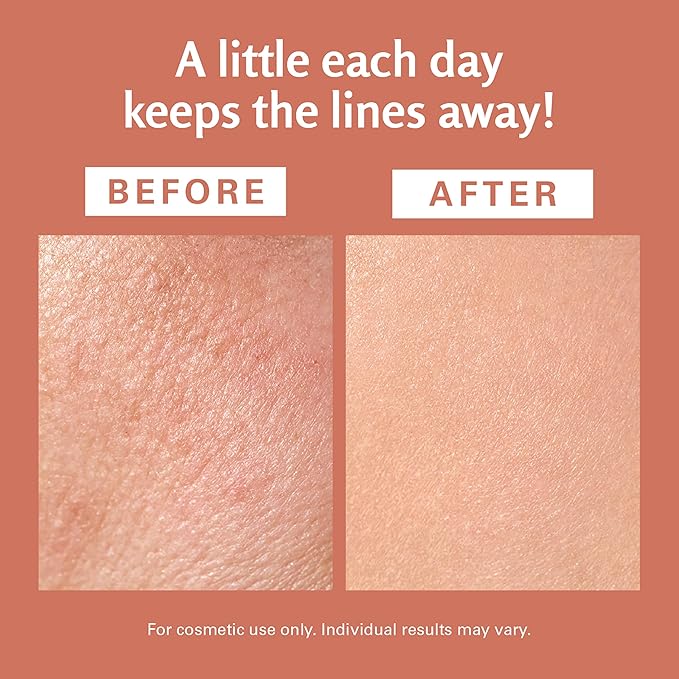 M3 Naturals Frankincense Essential Massage Oil for Scars, Stretch Marks & Fine lines, Firming, Hydrating, Smoothing & Calming Formula with Collagen, Stem Cells, Lavender & Grapefruit, 8 fl oz