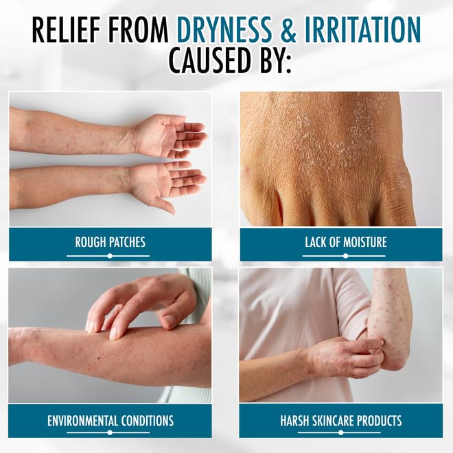 GLY MIRACLE Moisturizing Body Cream Lotion, 16 ounce - Non-Greasy Skin Humectant for Extremely Dry Skin, Hands, Body, and Feet, Light Fresh Scent with Pure Glycerin for Nourishing Hydration.