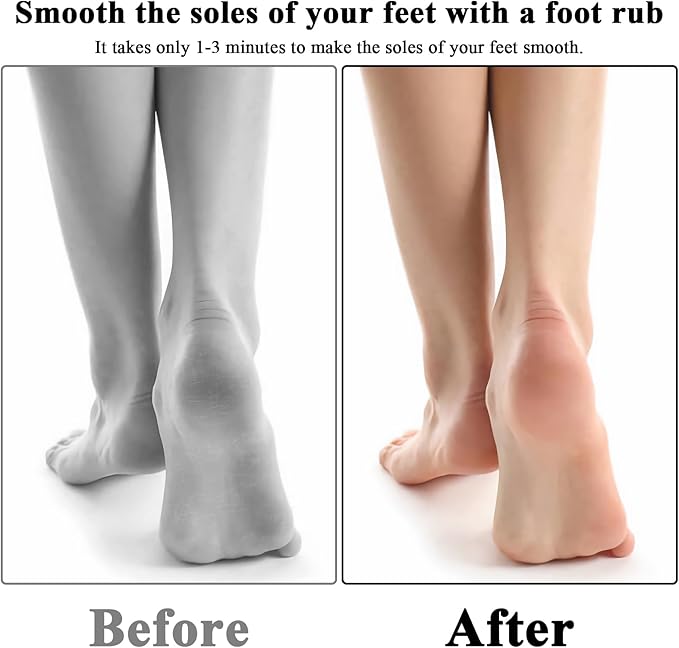 2Pcs Veinsgrain Foot File, Nano-Glass Foot File Hard Skin Remover, Summer Foot Beauty, Remove Dead Skin Foot Scrubber, Pedicure Tool for Smooth Feet, Practical Foot Care Tools (Blue&Gold)