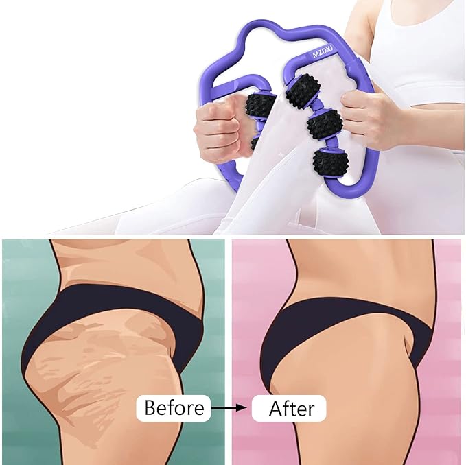 Cellulite Massage Tool Muscle Roller - Deep Fascia Massager & Dimpled Skin Remover for Legs, Thighs & Buttocks - Anti-Cellulite Roller, Smooth Skin, Pain Reliefs (Purple Black - 6 Wheel)