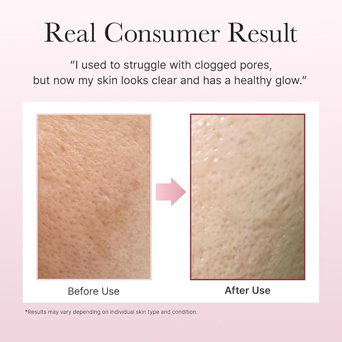 Fresh Rosehip Rice Mochi Cleanser