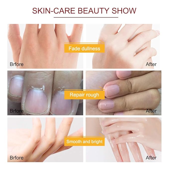 Hand Peeling Mask 5 pack, Hand Masks Moisturizing Gloves, Repairing Glove for Dry Skin, Remove Dead Rough Skin (honey and milk)