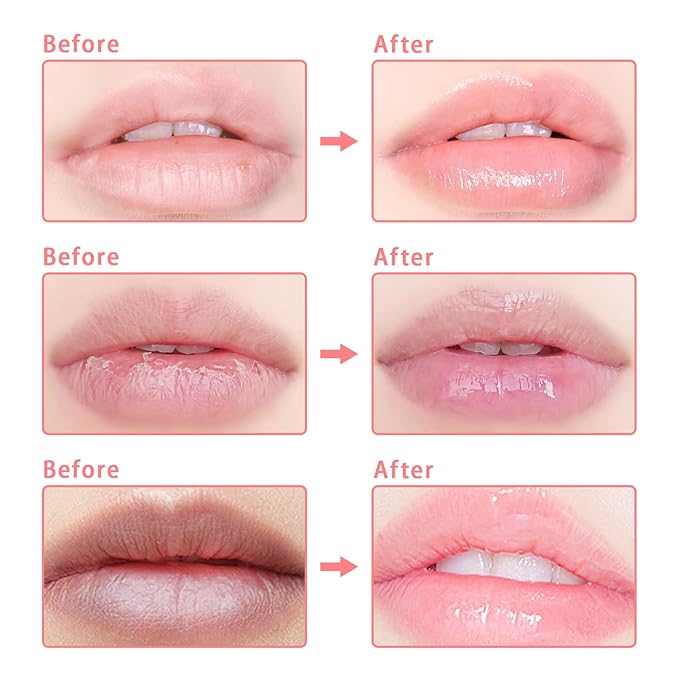 5 PCS Bee Lip Balm Honey Pot, Watermelon & Apple & Strawberry & Honey & Coconut Lip Mask Overnight Propolis Moisturizing Lip Balm Hydrating Prevention Dry and Crack (Set E)