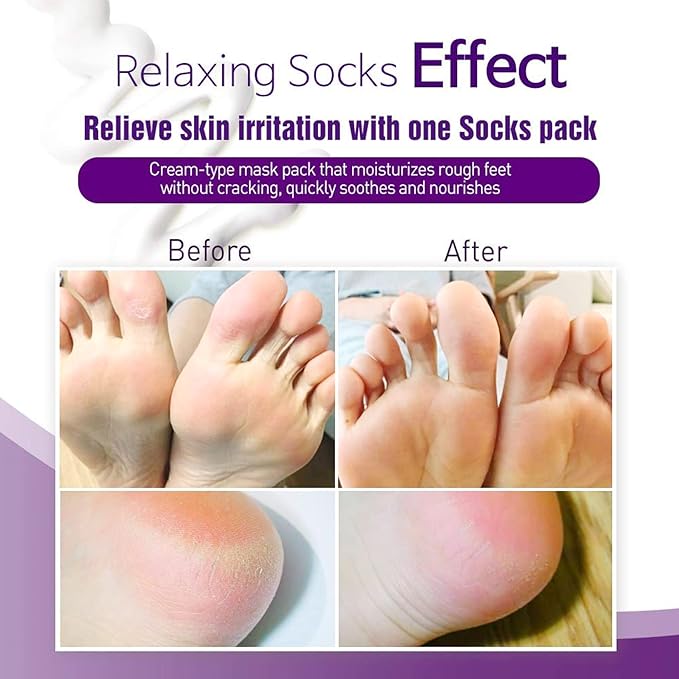 Epielle Relaxing Foot Masks 6 Pairs, Deep Moisturizing Socks for Dry Feet & Cracked Heels, Relax and Restore with Melatonin & Lavender Extract, Foot Spa & Self Care Gifts for Women, Korean Skin Care