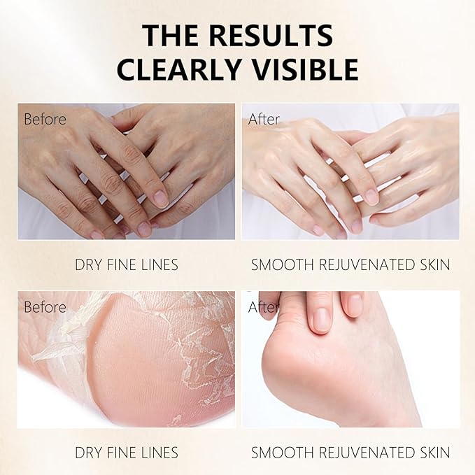 Hydrating Hand Foot Masks Set for Women Men,3 Pack Glove Mask for Dry Hand & 3 Pack Socks Mask for Dry Cracked Feet（Milk）