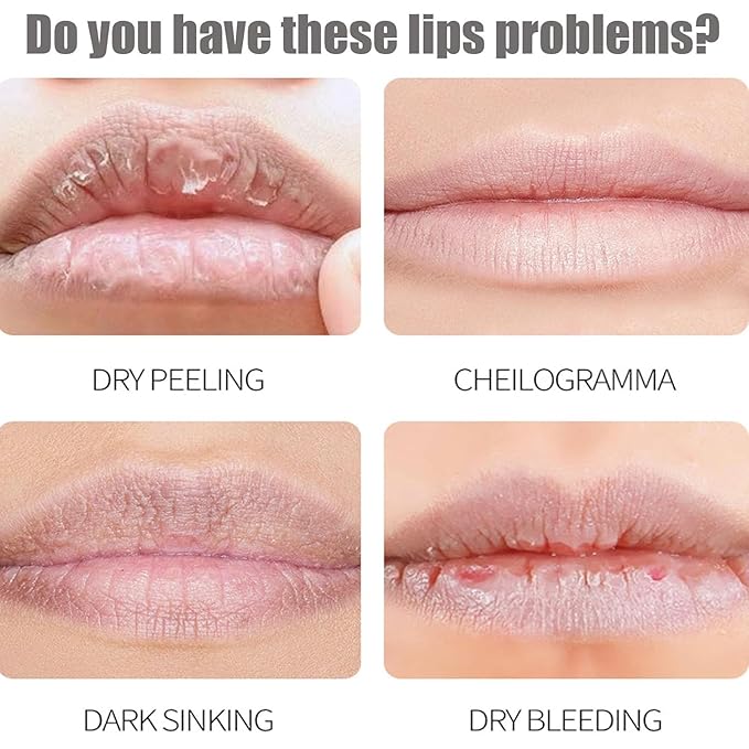 8PCS Fruit Flavored Lip Care Set, 8-in-1 Fruity Lip Set, Moisturizing & Repairing,Can Be Used as Glosses,Night Balms,Colorless Lipsticks and Moisturizing Masks, Perfect Party Seasonal (3PC)