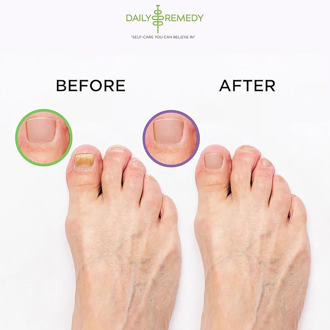 DAILY REMEDY EXTRA STRENGTH Tea Tree Oil & Calming Lavender Foot Soak Set - Made in USA - Soothes Sore Tired Feet, Athletes Foot, Stubborn Foot Odor, and Softens Calluses - Pack of 2