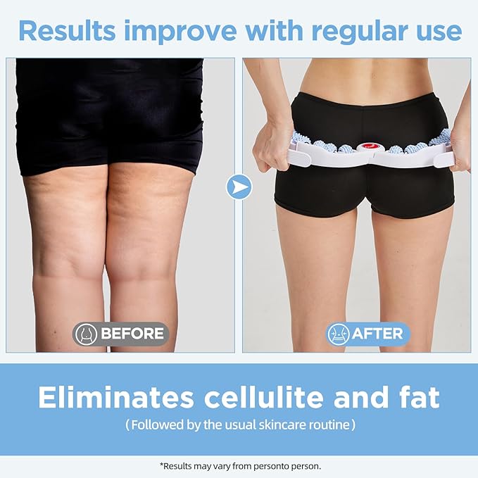 Cellulite Massage Tool Muscle Roller - Deep Fascia Massager & Dimpled Skin Remover for Legs, Thighs & Buttocks - Anti-Cellulite Roller, Smooth Skin, Pain Reliefs (Blue)