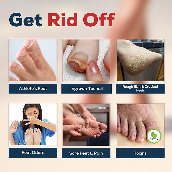 FOOT CURE Foot Soak with Epsom Salts – All-Natural Blend for Relaxing Foot Care – Softens Calluses & Refreshes Feet – Invigorating Scent, Spa Pedicure – 16 oz (Pack of 1)