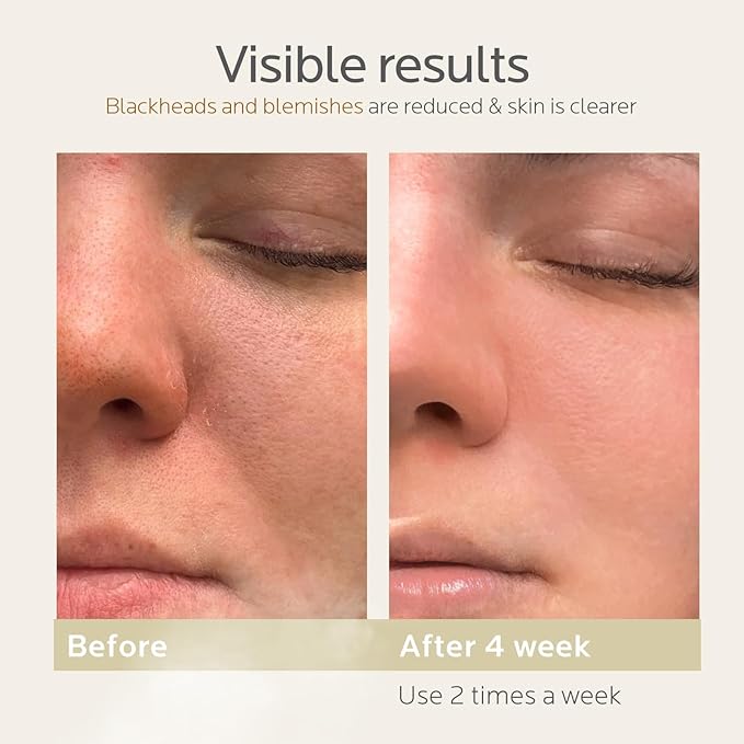 Colorfarm Facial Steamer Nano Ionic: Face Steamer Home Spa Kit Deep Cleaning Unclogs Pores Sinuses Inhaler with 8 Skin Care Tools - Relaxing Self Care Skincare Beauty Gifts for Women (Black Gold)