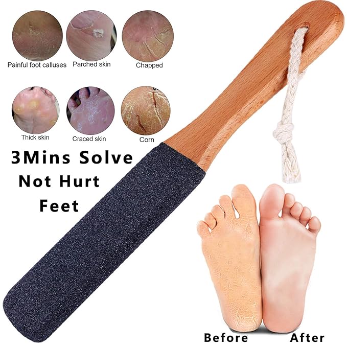 LEKESI Foot File Callus Remover Foot Scrubber,Professional Pedicure Foot Rasp Removes Cracked Heels,Dead Skin,Corn,Hard Skin,Pumice Stone for Feet Scraper File Brush Tools for Wet and Dry Feet