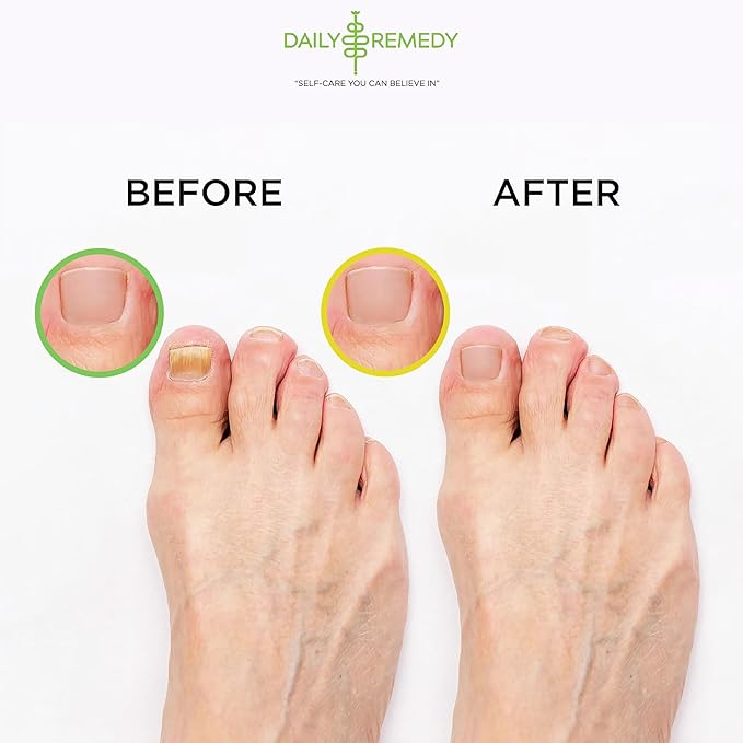 DAILY REMEDY EXTRA STRENGTH Tea Tree Oil & Citrus Detox Foot Soak Set - Made in USA - Soothes Sore Tired Feet, Athletes Foot, Stubborn Foot Odor, Softens Calluses & Refreshes & Detoxifies - Pack of 2