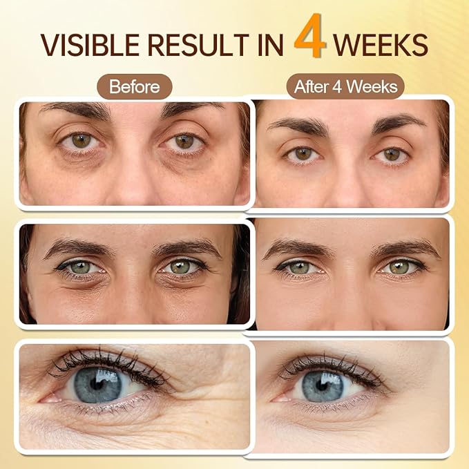 5% Caffeine Eye Serum for Dark Circles Wrinkles Puffy Bags & Fine Lines with Retinal Hyaluronic Acid Peptides, Instant Depuffing Eye Cream with 360° Roller Massage Ball, 0.51 fl oz