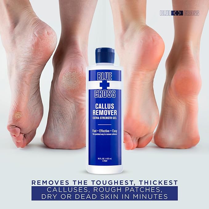 Blue Cross Callus Remover Gel for Feet or Heel, Extra Strength Professional Nail Care, File, Shaver, Scrubber & Pumice Stone Alternative for at Home Manicure/Pedicure Results, 16oz