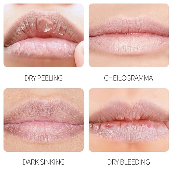 8Pcs Fruit Flavored Lip Care Set, Admd Lip Balm Set, 4-In-1 Mini Lip Balms Can Be Used Glosses, Moisturizing and Repairing Lip Mask, for Dry Peeling & Reducing Lip Lines (2Set)