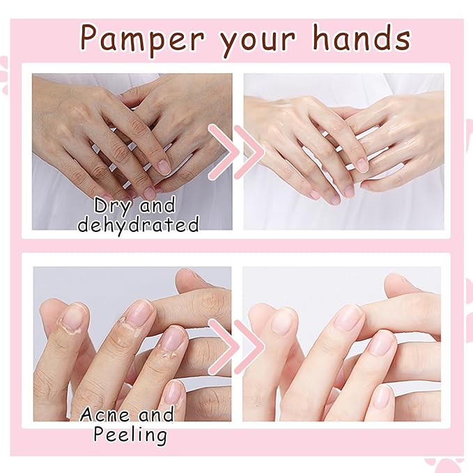 Hand Masks, 6 Pairs Hydrating Exfoliating Hand Peeling Mask, Smooth Hand Masks Moisturizing Gloves Overnight for Dry, Rough, Cracked Hands, Hand Skin Moisturizer Glove for Women Men（H