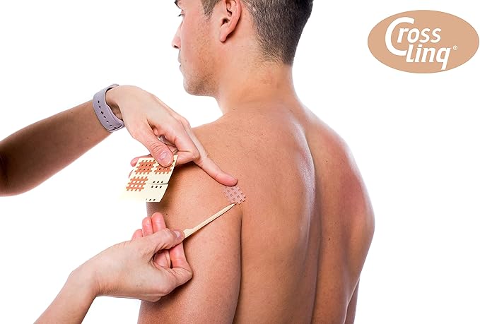 CrossLinq Acupressure Patches | Acupuncture Patch for Scars & Muscle Pain | Crosshatch Pain Patches | Non-Elastic Crosspatches | Small | (Pack of 240)