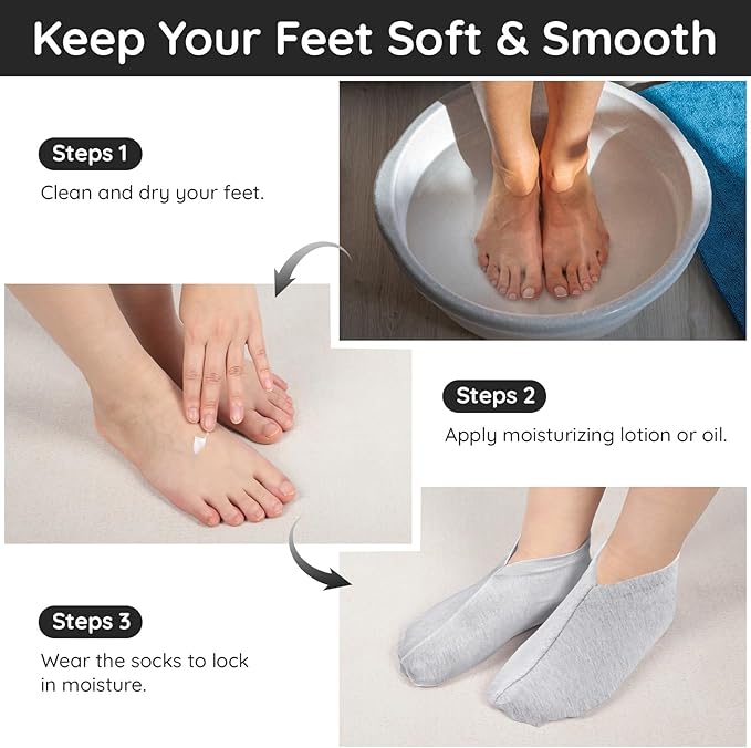 Segbeauty 12 Count Moisturizing Heel Socks for Dry Cracked Feet Women, 6 Pairs Lotion Sleep Cotton Socks for Cracked Heel Repair Women, Spa Overnight Sock Foot Care Products, Sleeping Feet Care Kit