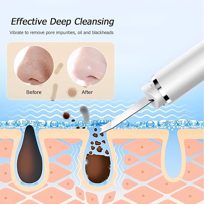 Face Scrubber Skin Spatula, Black Head Remover for Face and Nose, Pore Cleaner Blackhead Remover Tools, Deep Cleansing Facial Whitehead Removal Extractor, Skin Care Gifts for Women