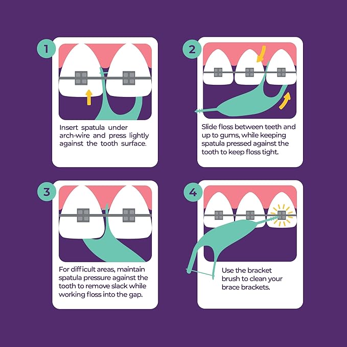 Platypus Orthodontic Flossers for Braces, 30 Count (Pack of 1), Ortho Picks for Adults & Kids, Fits Under Arch Wire, Non-Damaging, Encourage Flossing Habits
