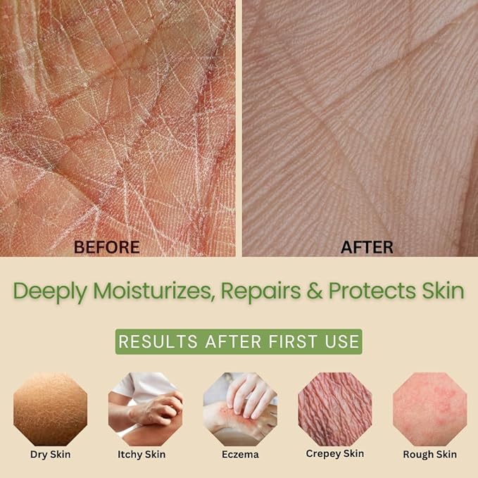 Moisturizing & Firming Lemongrass Body Lotion & Hand Cream - Natural Moisturizer for Dry Skin, Itchy or Crepey Skin - Eczema Treatment - Olive Oil, Coconut Oil & Avocado Oil - 8oz