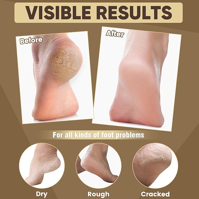 18 Pairs Moisturizing Foot Masks with Castor Oil & Jojoba Oil, Intensely Hydrating Foot Mask for Dry Cracked Feet, Moisturizing Socks for Cracked Heel Treatment