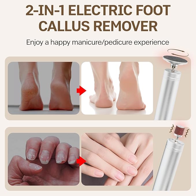 Electric Foot Callus Remover, 2 in 1 Electric Nail File Kit, Multispeed Adjustable Foot Scrubber with Sandpaper Disk, Foot File Pedicure Tools for Feet Dead Skin