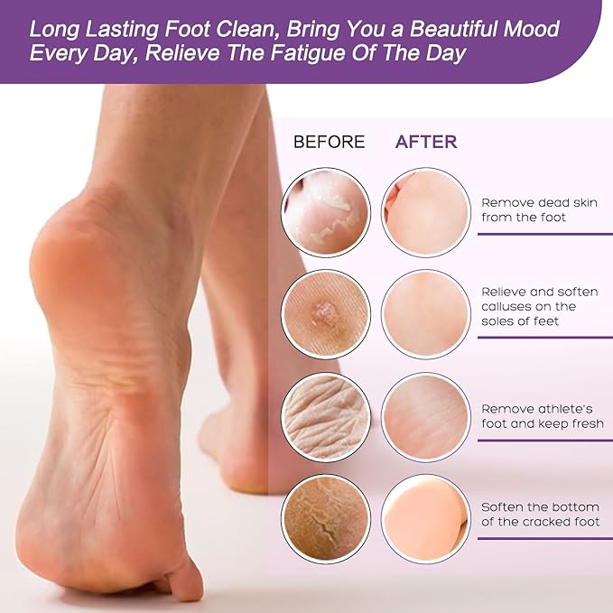 40 Packs of Foot Bath soak Salts kit Lavender Epsom Salts Tea Tree Oil Dry Cracked HEE Toenail Athletes Foot, Stubborn Foot Odor Scent, Softens Calluses Pedicure Tired Feet spa Message