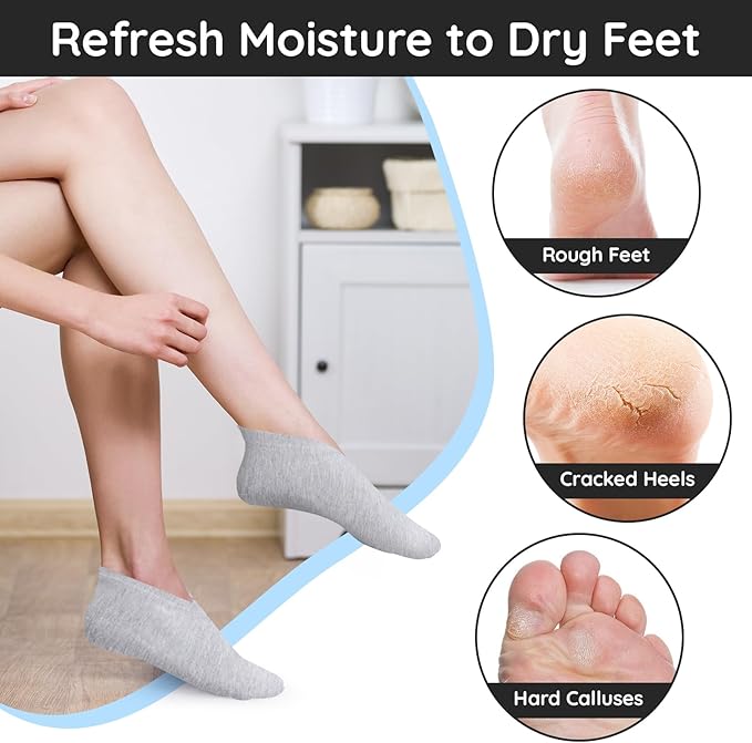 Segbeauty 12 Count Moisturizing Heel Socks for Dry Cracked Feet Women, 6 Pairs Lotion Sleep Cotton Socks for Cracked Heel Repair Women, Spa Overnight Sock Foot Care Products, Sleeping Feet Care Kit
