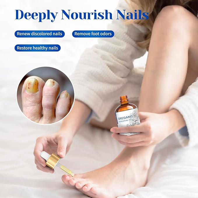 HIQILI 100 ML Oregano Essential Oil, 100% Pure Natural Oregano Oil for Diffuser, Skin, Cleaning - 3.38 Fl Oz