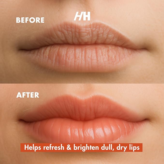 Handmade Heroes Turmeric Lip Scrub with Vitamin C – 100% Natural Vegan Exfoliant for Dark Dry Chapped Lips – Deep Conditioning Sugar Polish 1oz